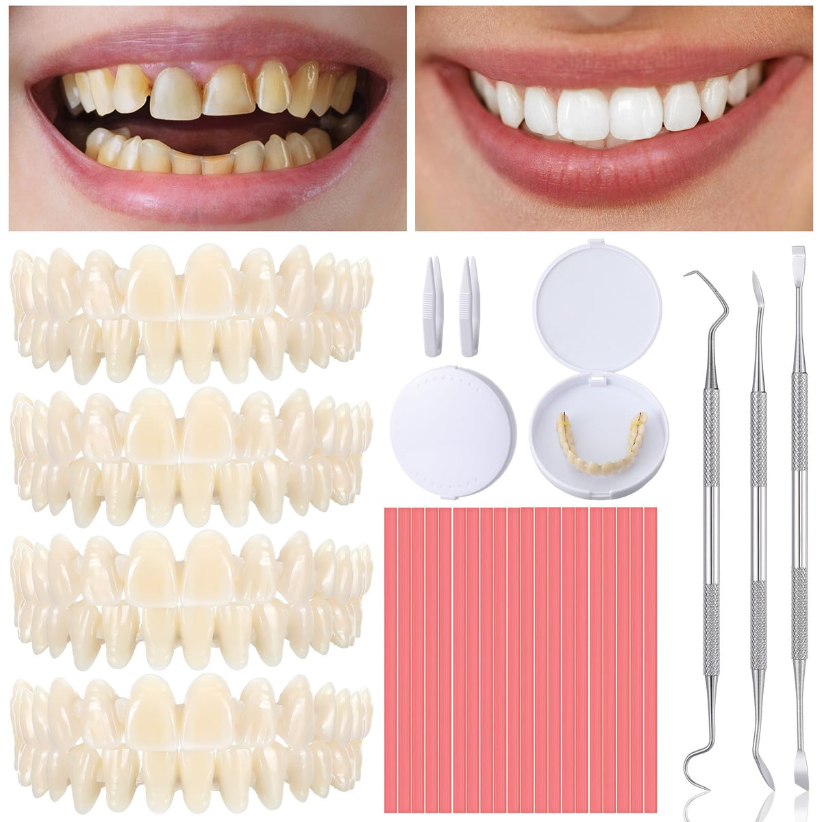 35 Pcs Dentures Repair Kit with Tools D671
